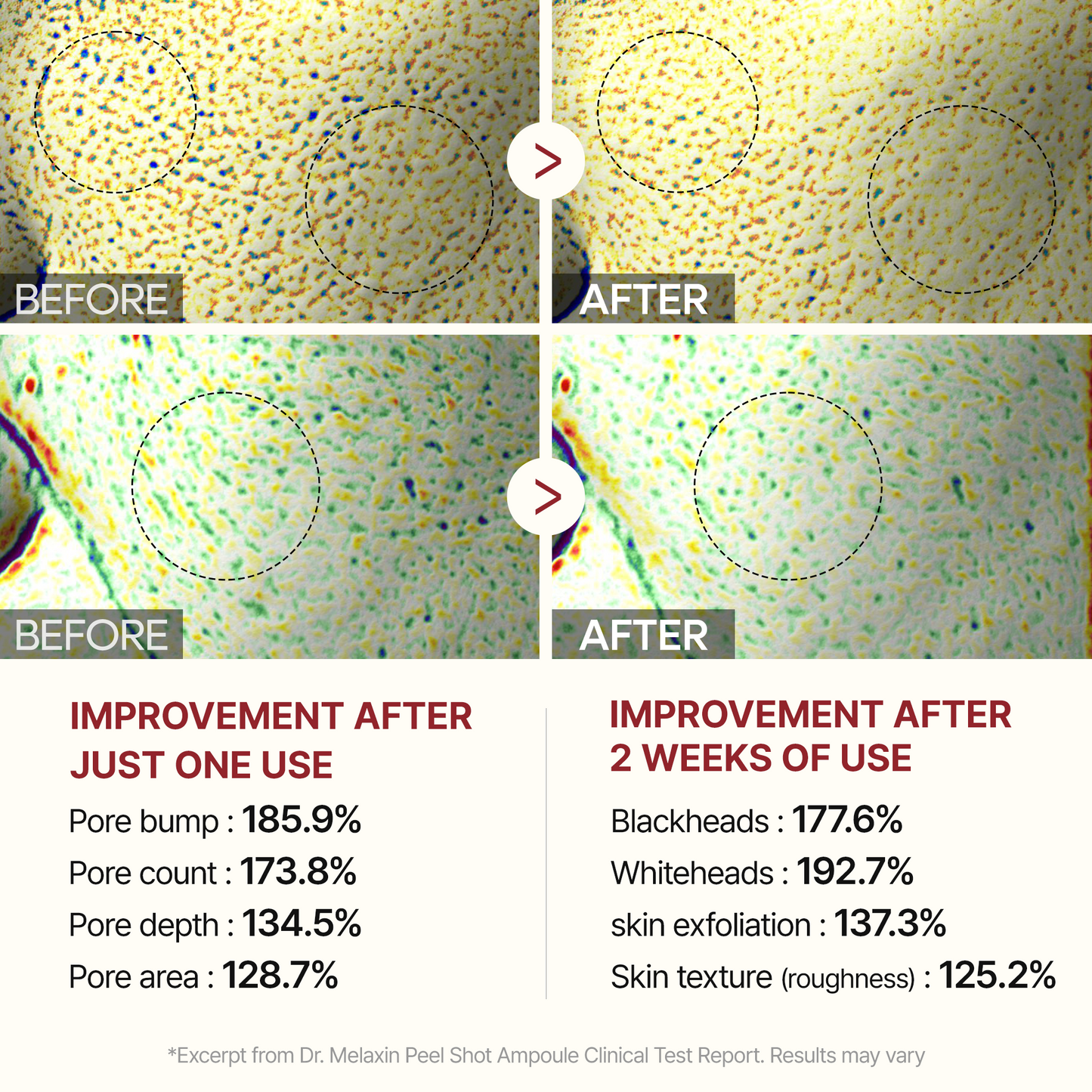 Peel Shot Glow White Rice Ampoule-Shop