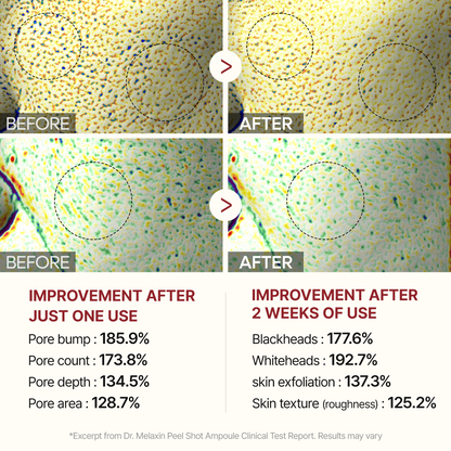 Peel Shot Glow Black Rice Ampoule-Shop