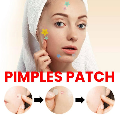 Pimple Patches,Pimple Patches For Face, Hydrocolloid Acne Patches, Cute Star Sti-Shop