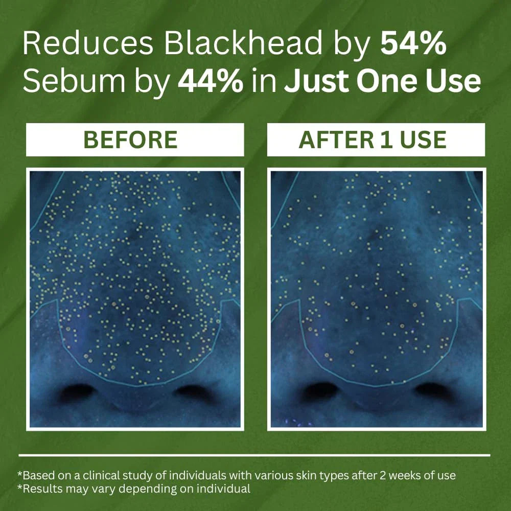 P.CALM Holy Basil Bubble Deep Mask – Holy Basil & Carbonated Water for Cleansing-Shop