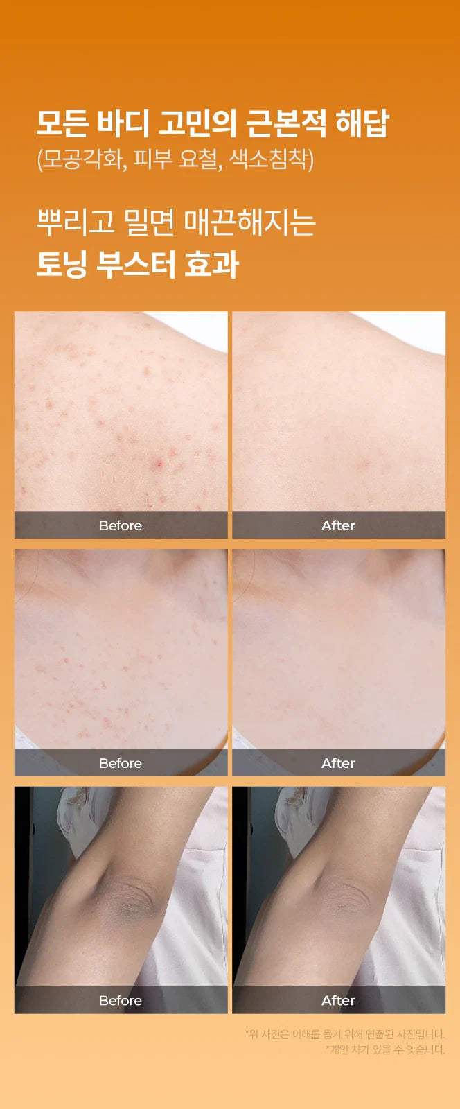 Dr.Melaxin Peel Shot Exfoliating Kojic Acid Turmeric Spray 200ml(6.76oz)K-beauty-Shop