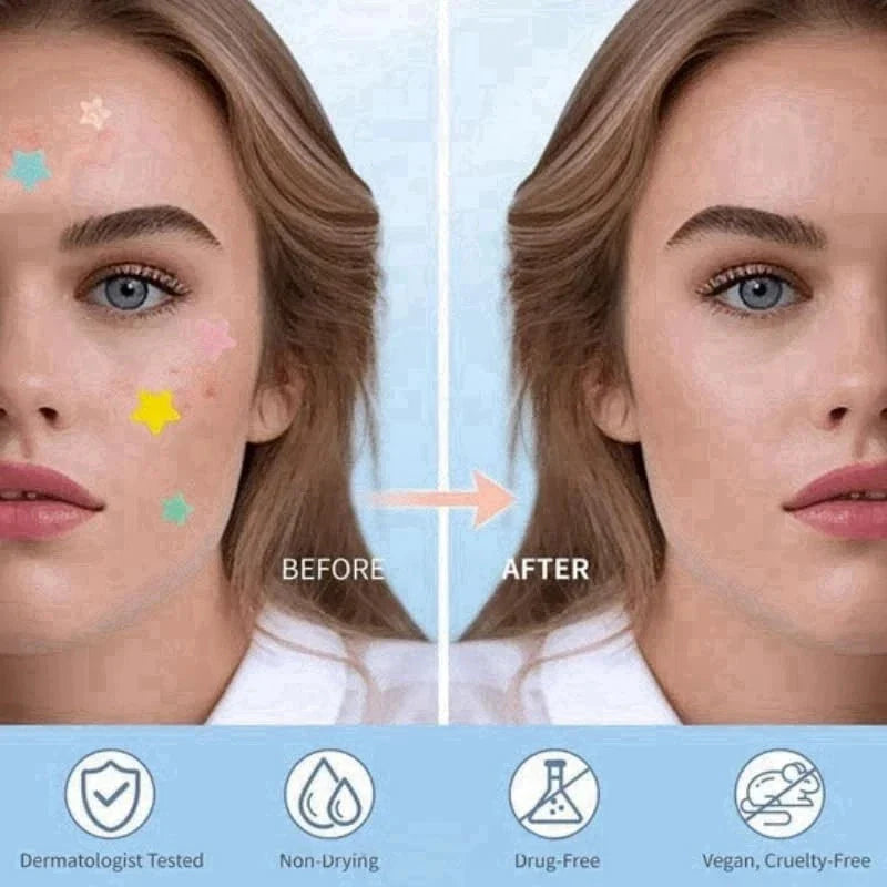 Pimple Patches for Face, 200 Pcs in 5 Sizes & Colors, Hydrocolloid Acne Treatmen-Shop