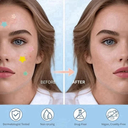 Pimple Patches for Face, 200 Pcs in 5 Sizes & Colors, Hydrocolloid Acne Treatmen-Shop