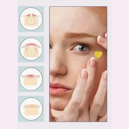 Pimple Patches for Face, 200 Pcs in 5 Sizes & Colors, Hydrocolloid Acne Treatmen-Shop