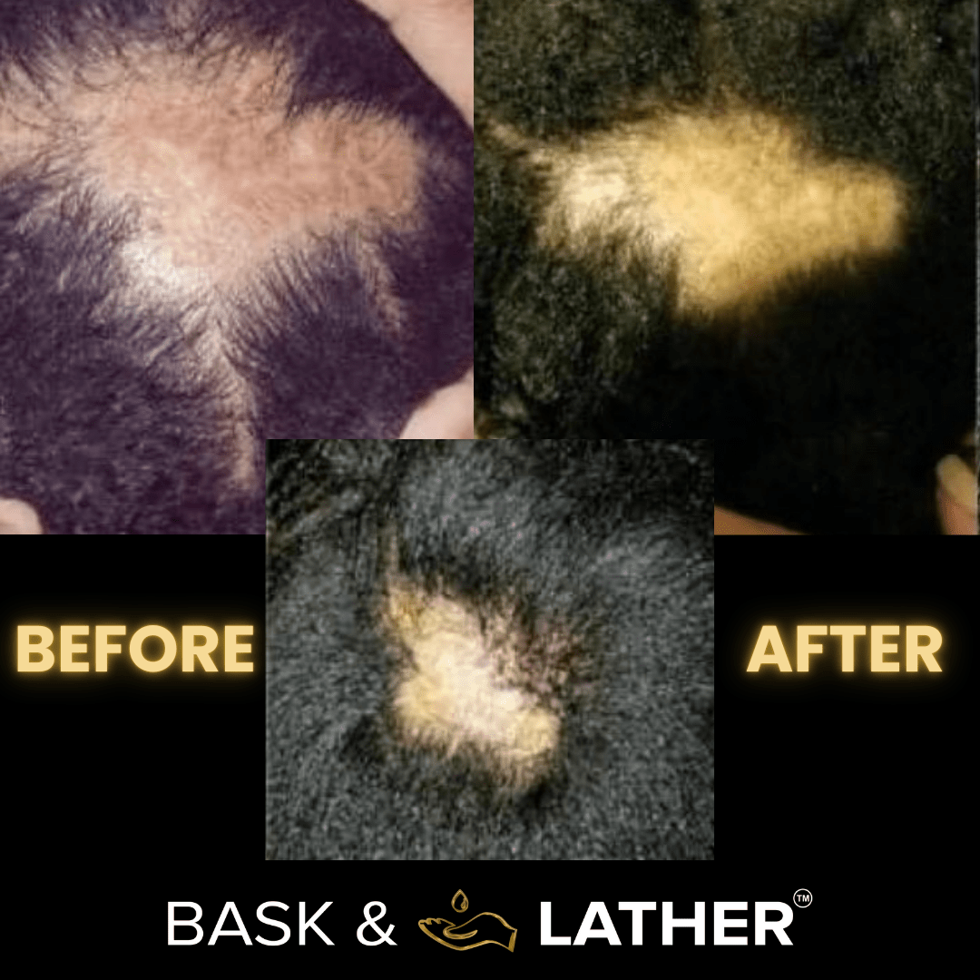 Scalp Stimulator | Hair Growth Oil-Shop