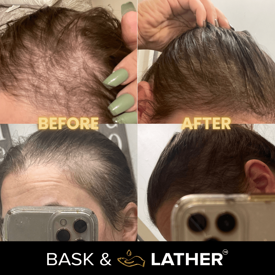 Scalp Stimulator | Hair Growth Oil-Shop