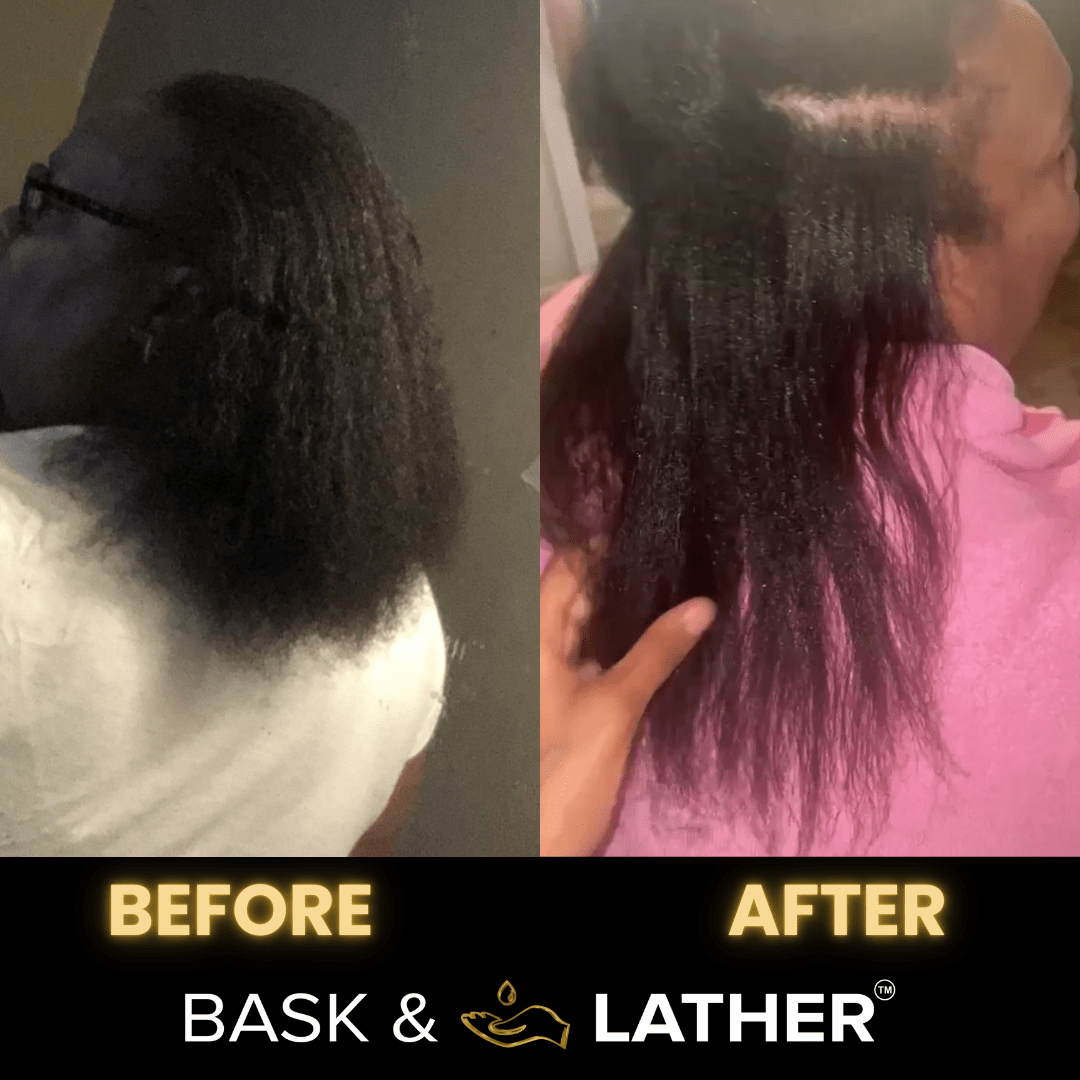 Scalp Stimulator | Hair Growth Oil-Shop